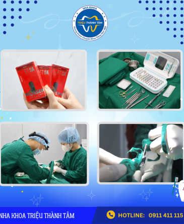Trụ Implant Hiossen ( Mỹ ) Có Xuất Xứ Và Giá Cả Như Thế Nào?