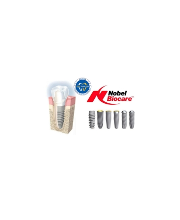 Trồng răng implant có nguy hiểm không?