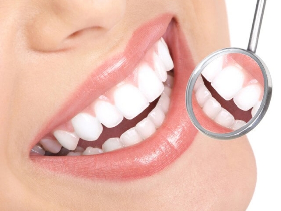 Trang chủ Sức khỏe răng miệng Nha khoa thẩm mỹ Tẩy trắng răng có tốt không? Ưu, nhược điểm của từng biện pháp tẩy răng