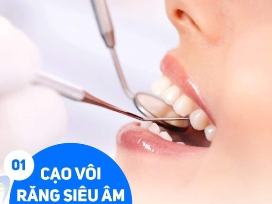 Vôi Răng Là Gì? Có Nên Cạo Vôi Răng Không?