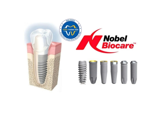 Trụ Implant Nobel Có Xuất Xứ Và Giá Cả Như Thế Nào?